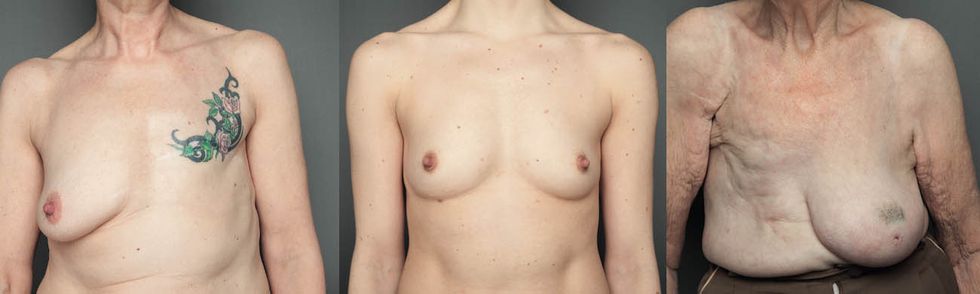 bare reality breast composite.jpg