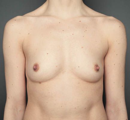 bare reality breast 02a.jpg